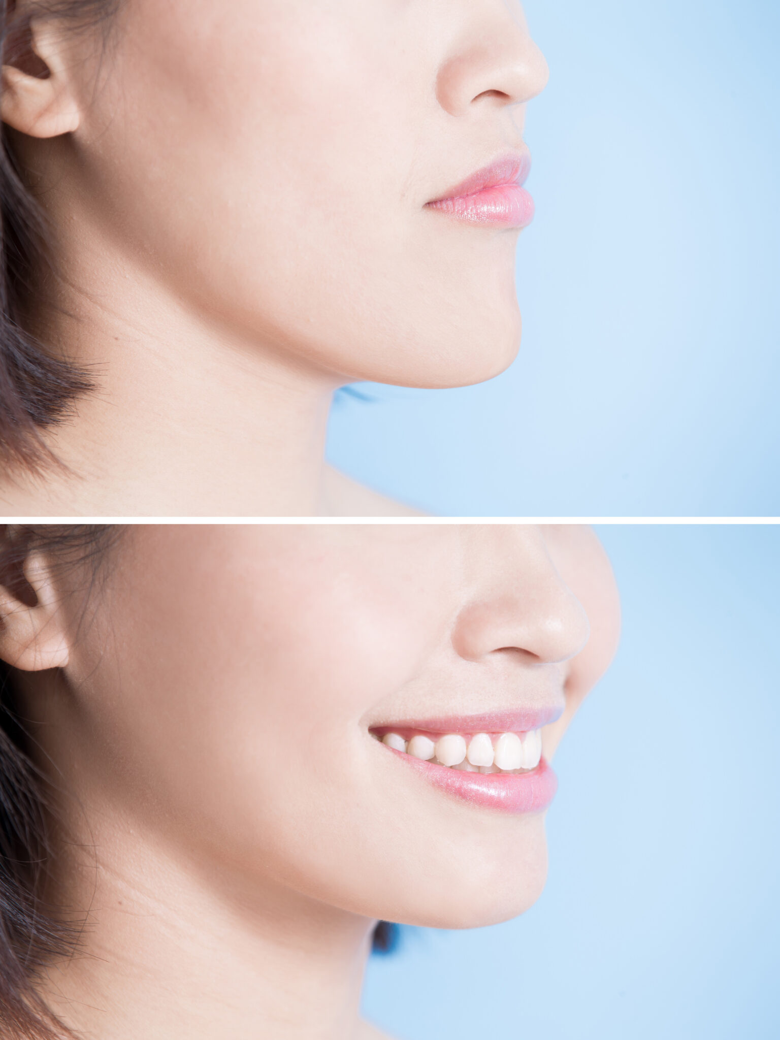 Corrective Jaw Surgery ANZAOMS